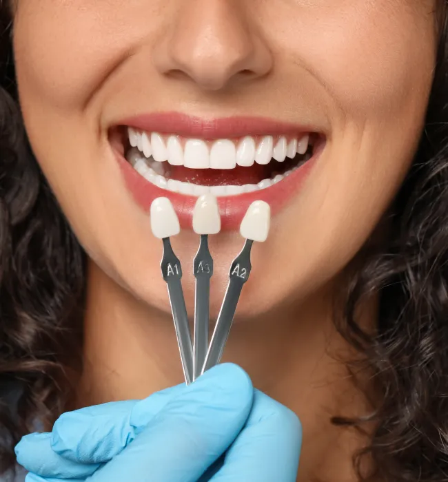 Veneers at Hillside Family Dental